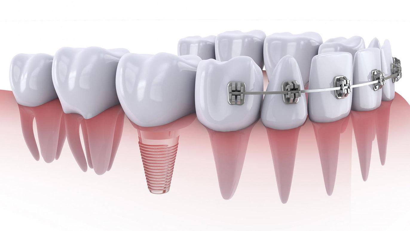Images Tandtekniker Peggy og Susan Berthelsen