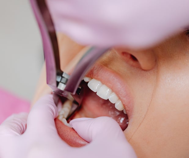 Images Silver State Dental