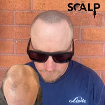 Images The Scalp Master