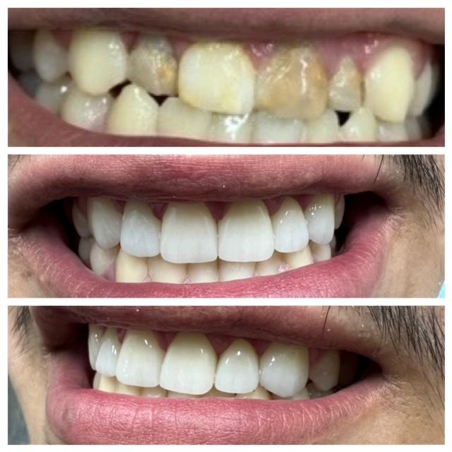 Images Best Dental - Family & Orthodontics