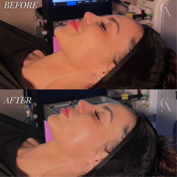 Images Corinne Aesthetics | Laser & Skin