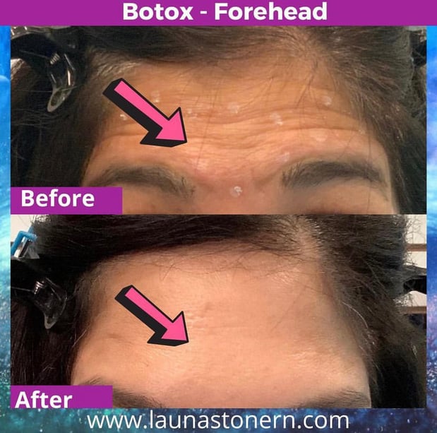 Images Launa Stone, R.N.