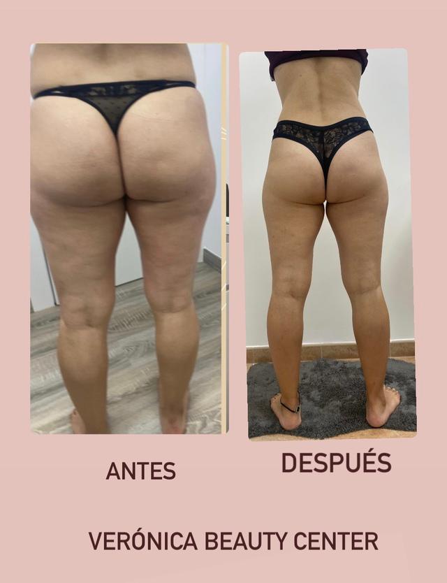 Images Verónica Beauty Center