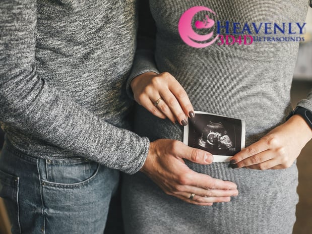 Images Heavenly 3D 4D Ultrasounds