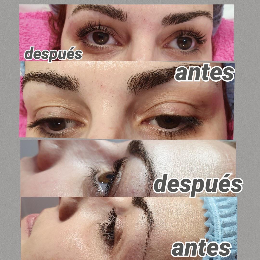 Images Centro De Estética Avanzada Y Láser Verónica Vico