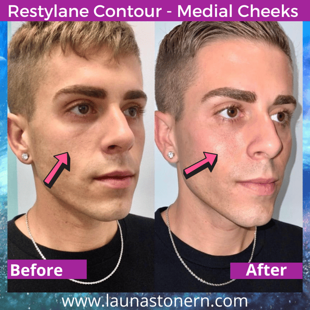 Images Launa Stone, R.N.