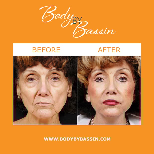 Images Body By Bassin Melbourne