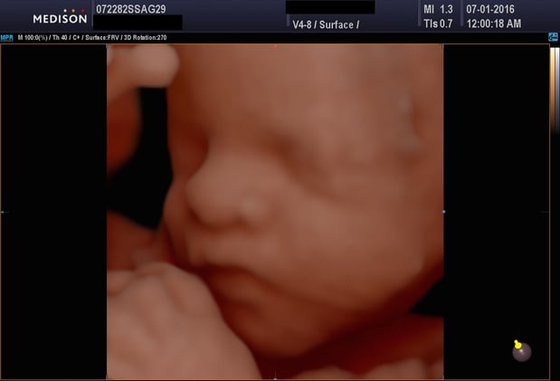 Images Heavenly 3D 4D Ultrasounds