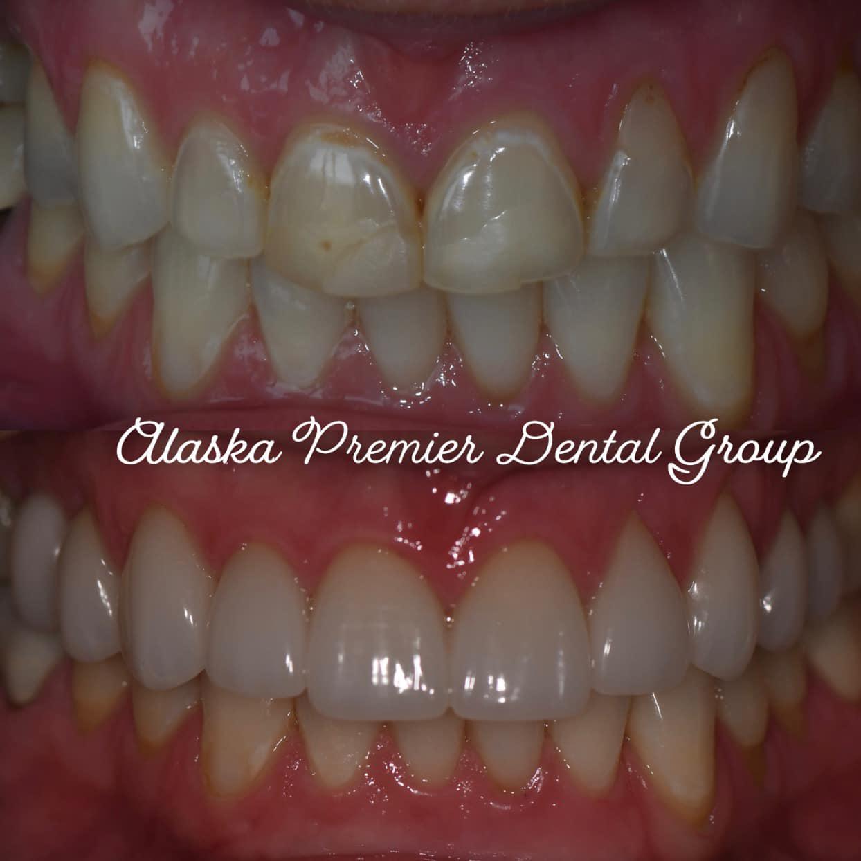 Alaska Premier Dental Group-Wasilla Wasilla (907)373-5930