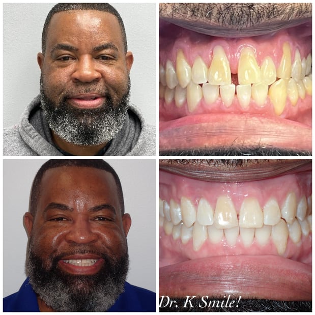 Images Reston Heights Dental