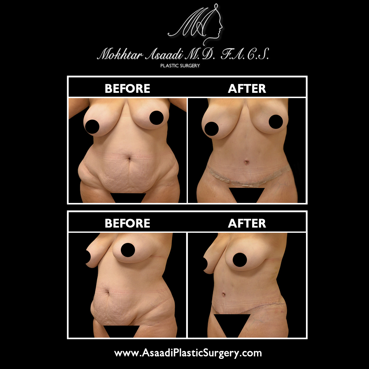 Asaadi Plastic Surgery Image