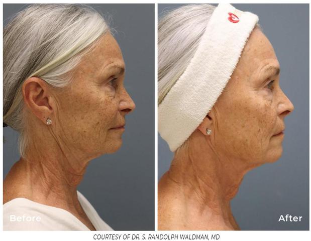 Images Tactus Health Aesthetics & Weight Loss Clinic