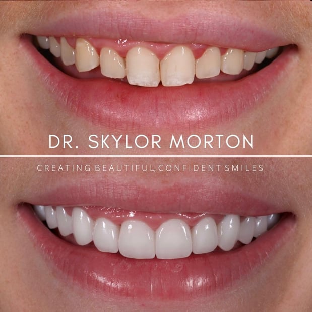 Images Nashville Wisdom Teeth and Implant Solutions