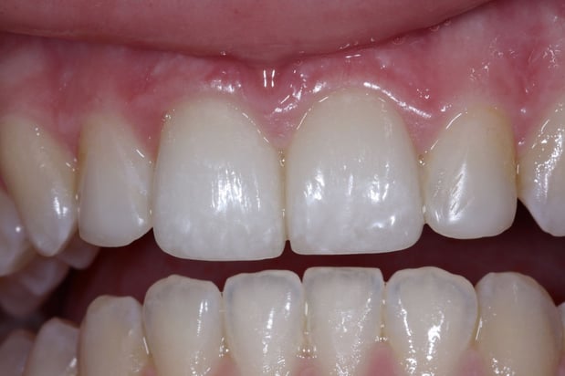 Images North Salem Dental Care