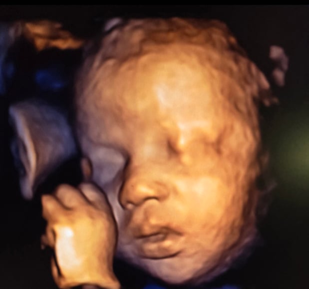 Images Love At First Sight 3D/4D Ultrasound Imaging Studio, LLC