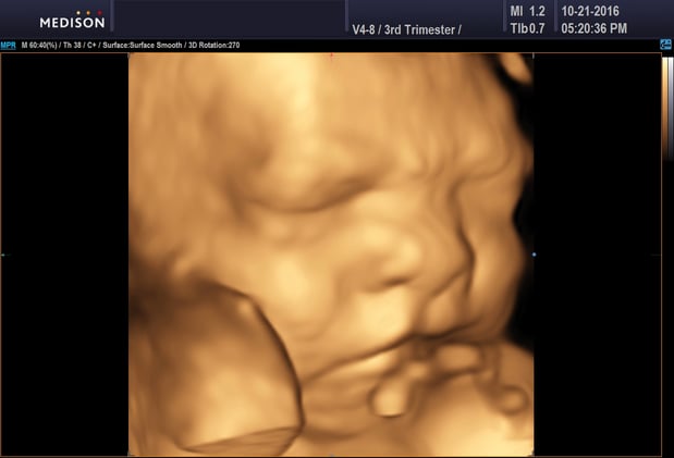 Images Heavenly 3D 4D Ultrasounds
