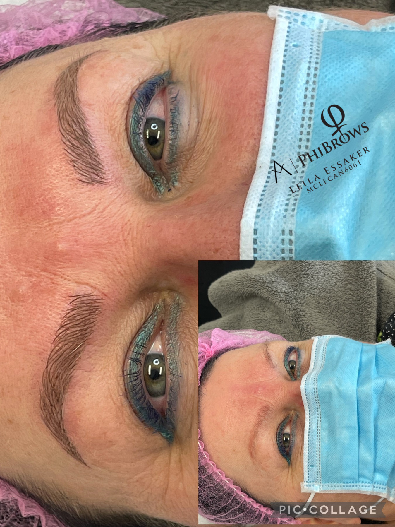 Images Clinique d'Esthétique Leila - Hydrafacial, Microblading, Épilation Laser Sainte-Foy