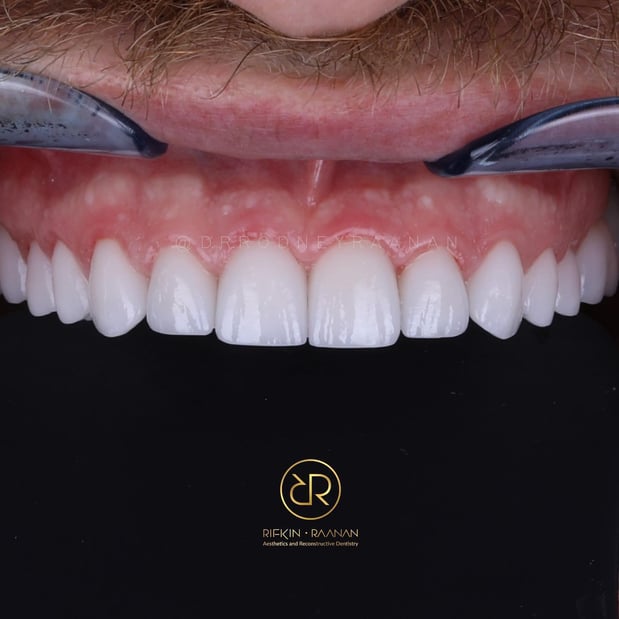 Images Dr. Rodney Raanan