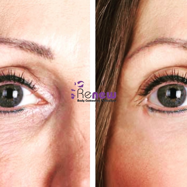 Images Renew Body Contouring & MedSpa