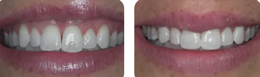 Images Paige Prather Smiles