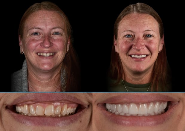 Images Dolecki Advanced Dentistry & Implants