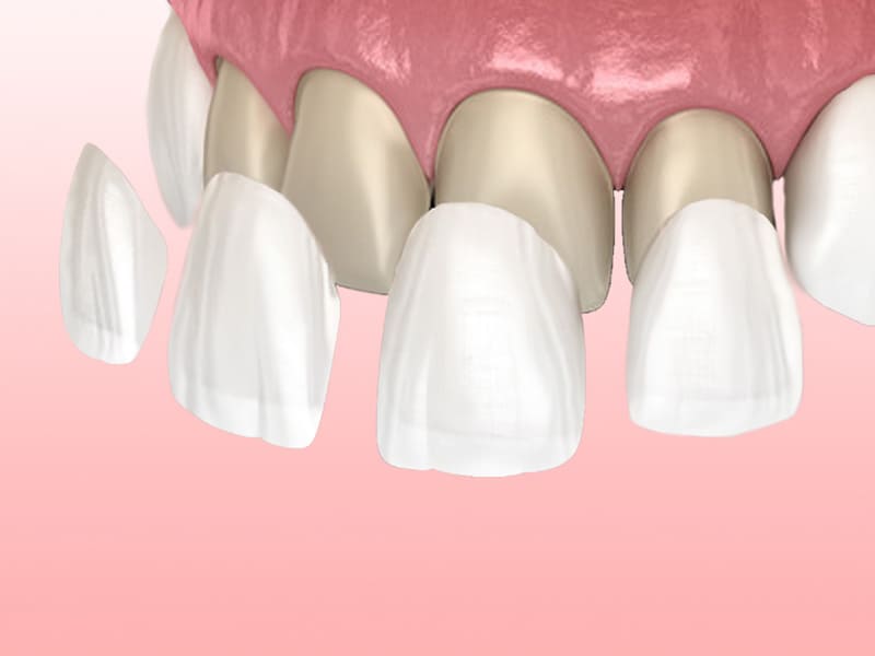 Images Dada Studi Dentistici