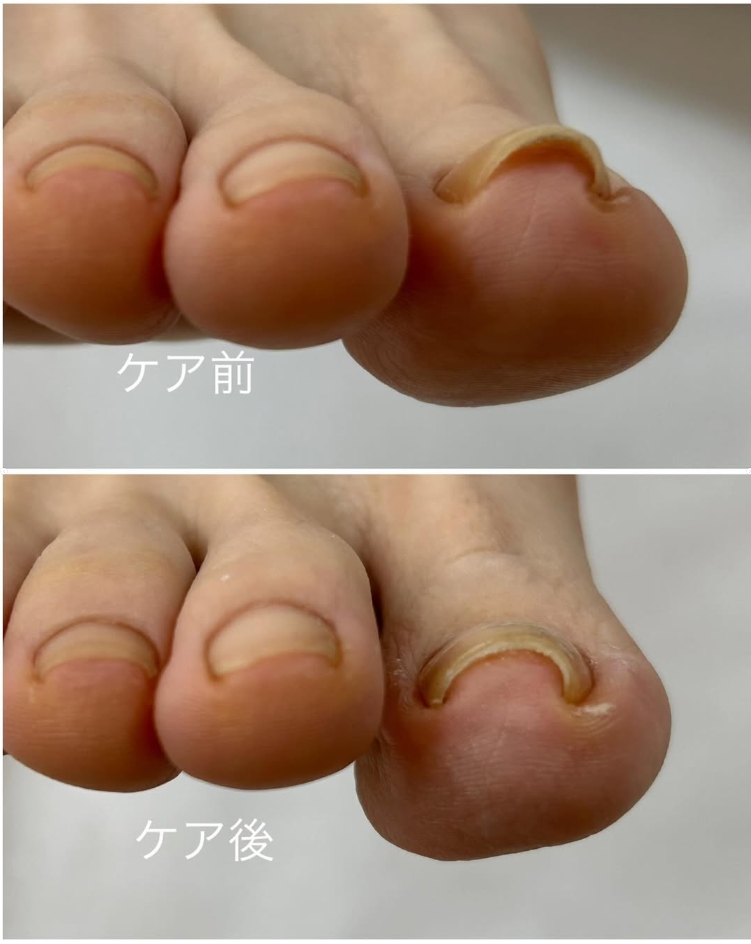 Images 足の専門店 おん