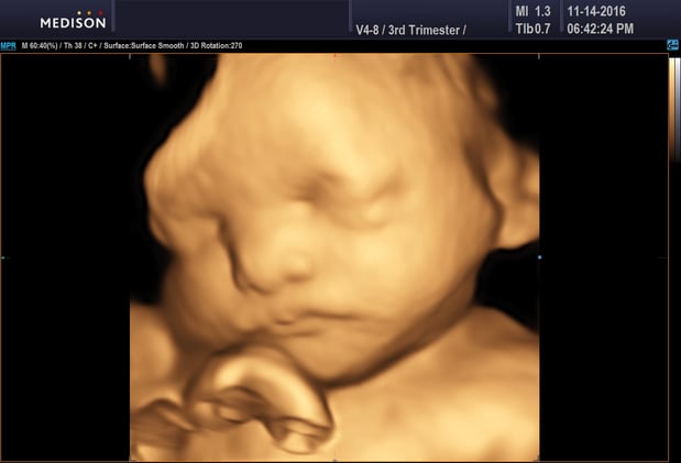 Images Heavenly 3D 4D Ultrasounds