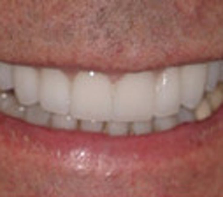 Results at Exton Dental Health Group | Exton, PA