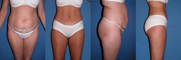 Images Devlin Cosmetic Surgery