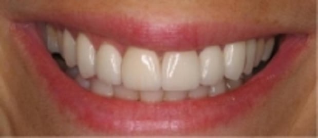 Images Glenlake Dental Care