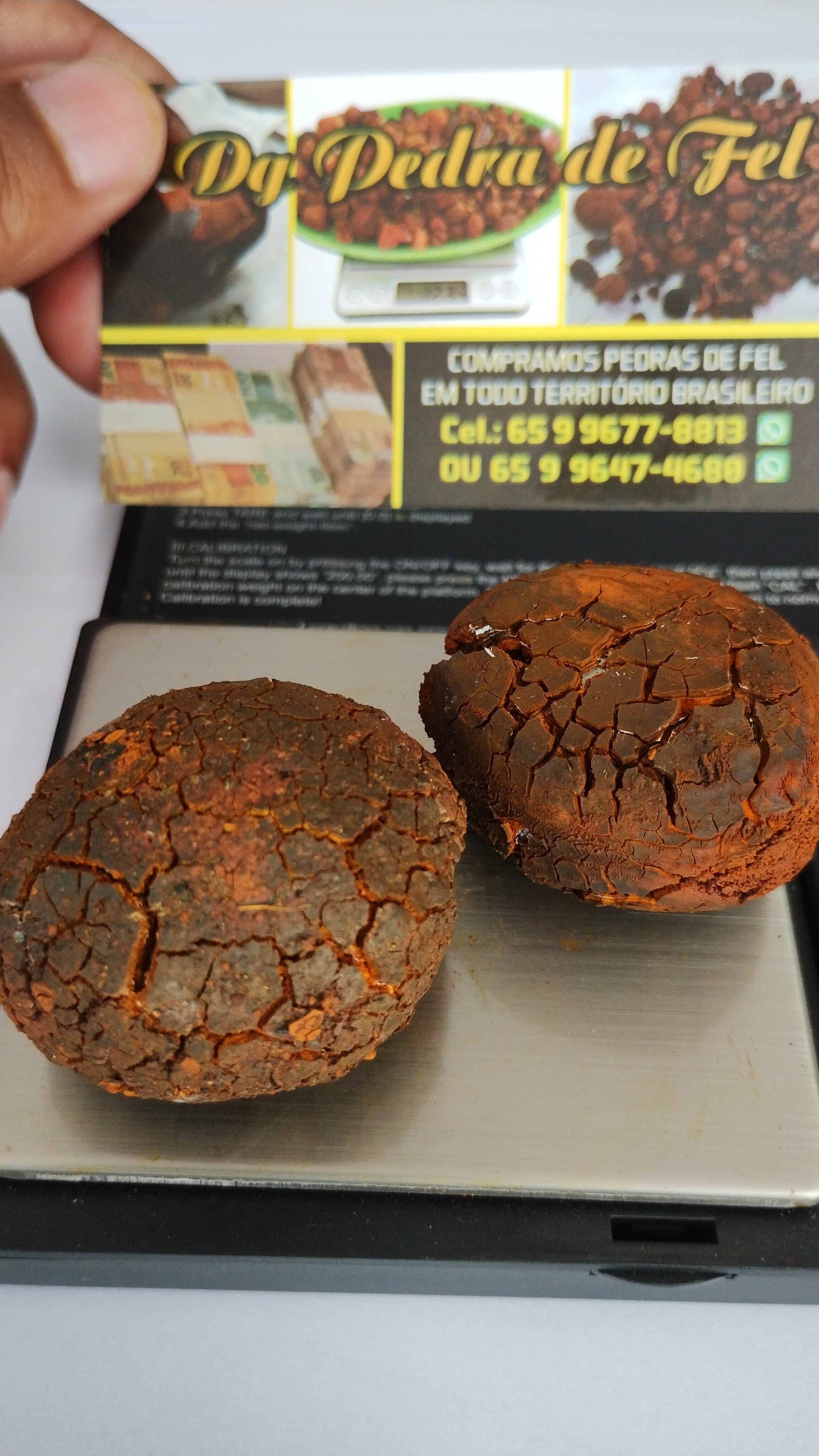 Images Dg pedras de fel bovinos