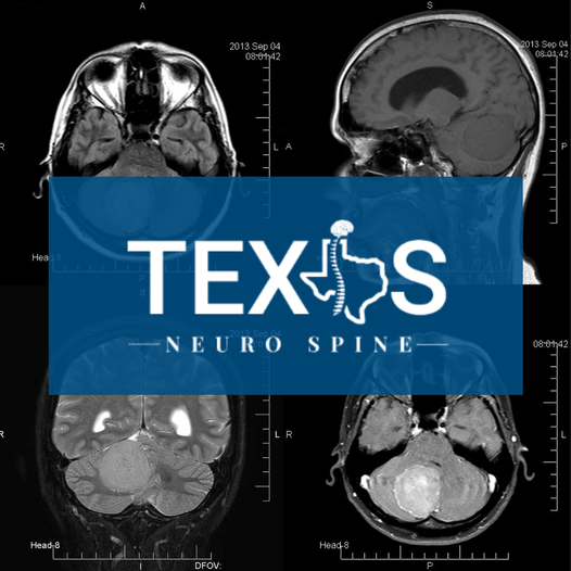 Images Texas Neuro Spine Office
