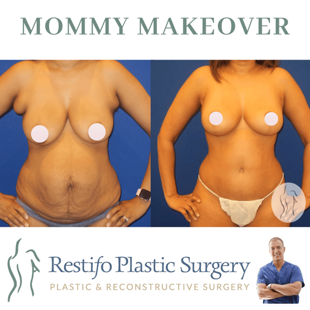 Images Restifo Plastic Surgery
