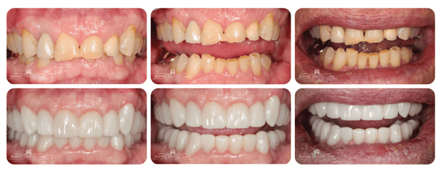 Images Aspire Dental Care PLLC
