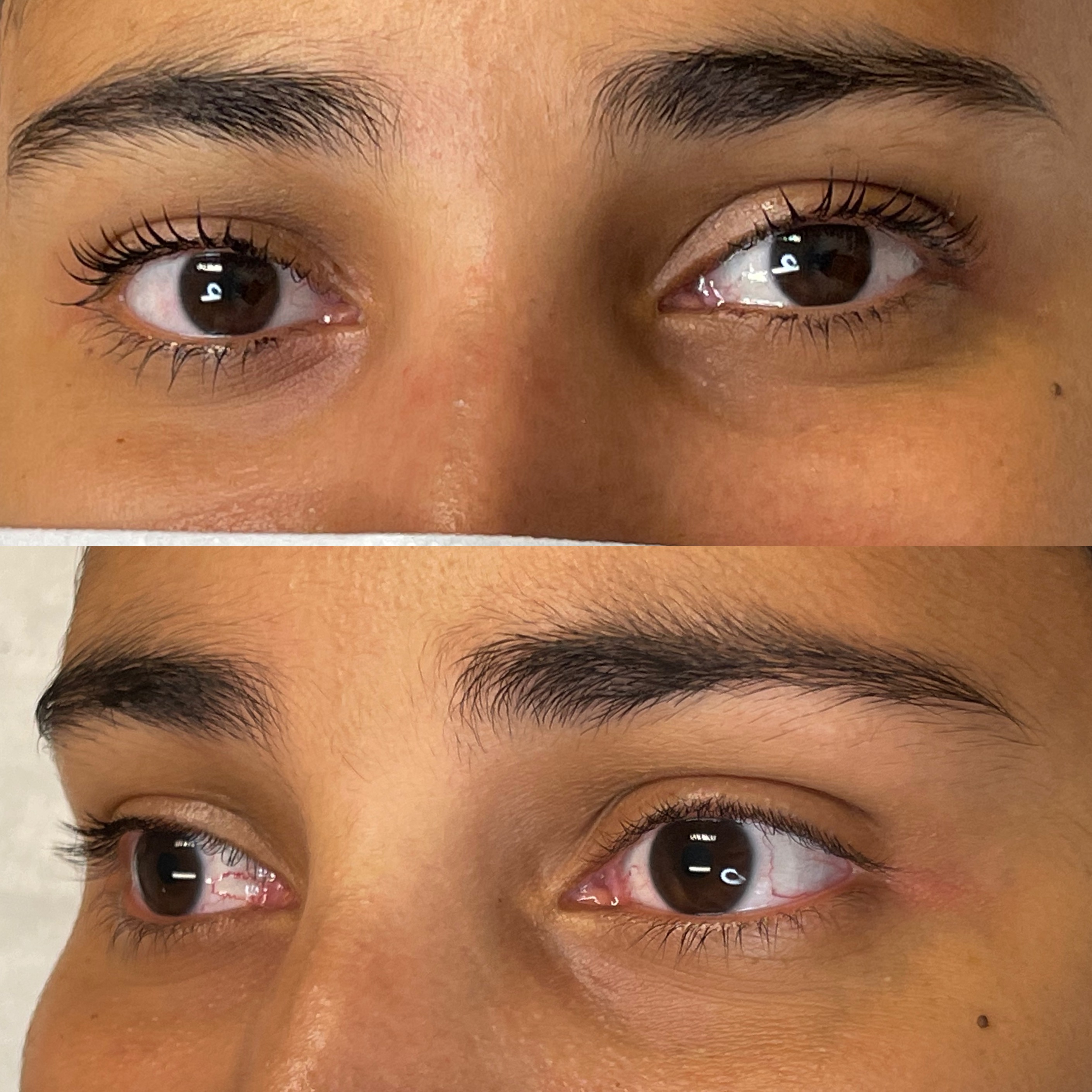 Images Clinique d'Esthétique Leila - Hydrafacial, Microblading, Épilation Laser Sainte-Foy