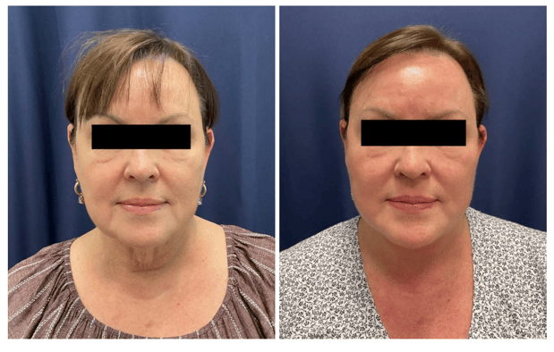 Images Columbia Aesthetic Plastic Surgery