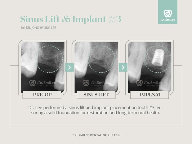Images Dr Smilee Dental of Killeen, Family, Cosmetic, Implant, Medspa