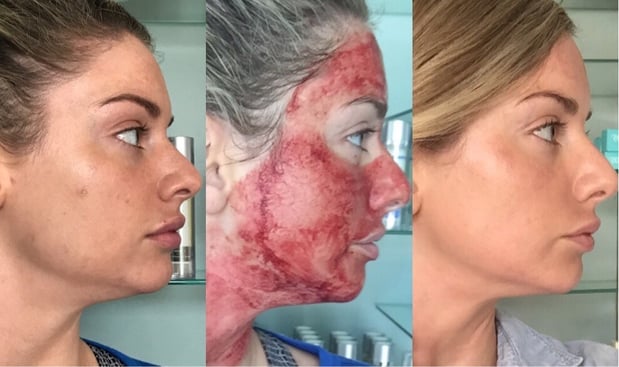 Images Permanent Makeup & Aesthetics in Maine