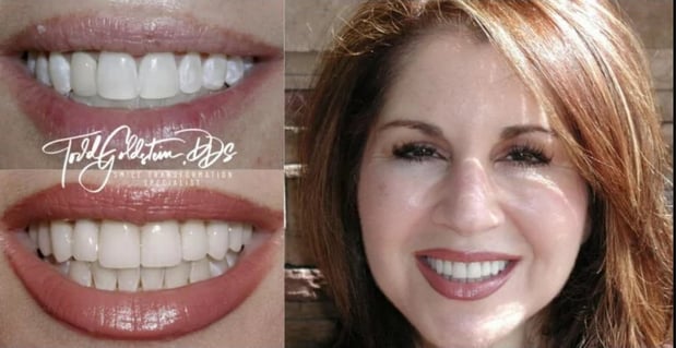 Images Todd Goldstein DDS