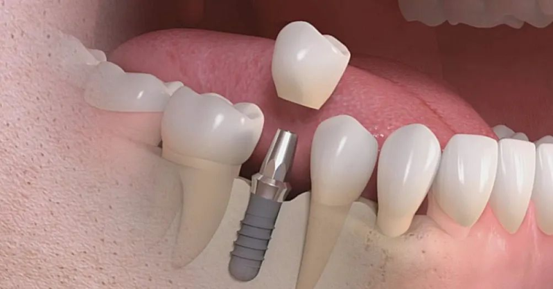 Images Cantarella Dr.ssa Vincenzina - Studio Dentistico