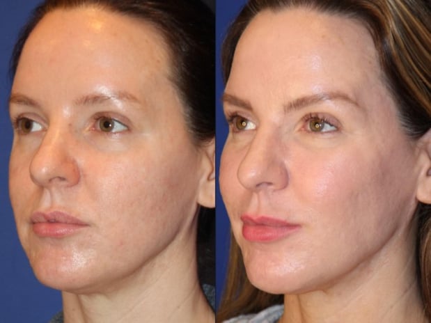 Images Troell Cosmetic Surgery & Facial Plastic Clinic
