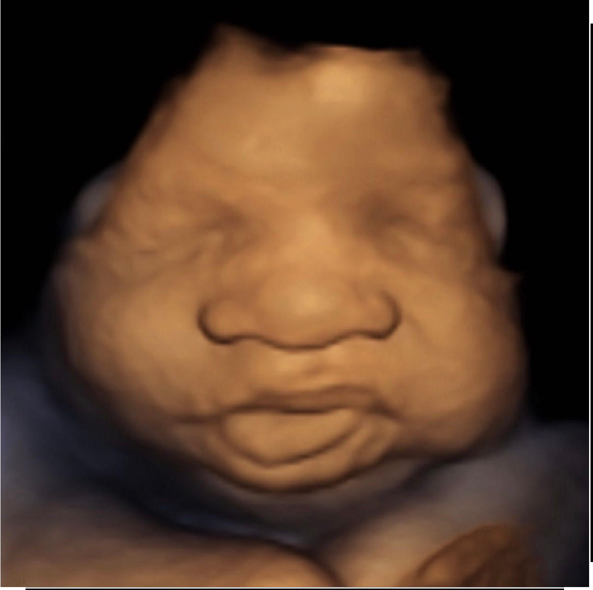 Image 3 | Belly 2 Birth 3D 4D Ultrasound
