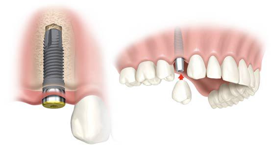 Kinsale Dental & Implant Centre 14