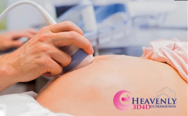Images Heavenly 3D 4D Ultrasounds