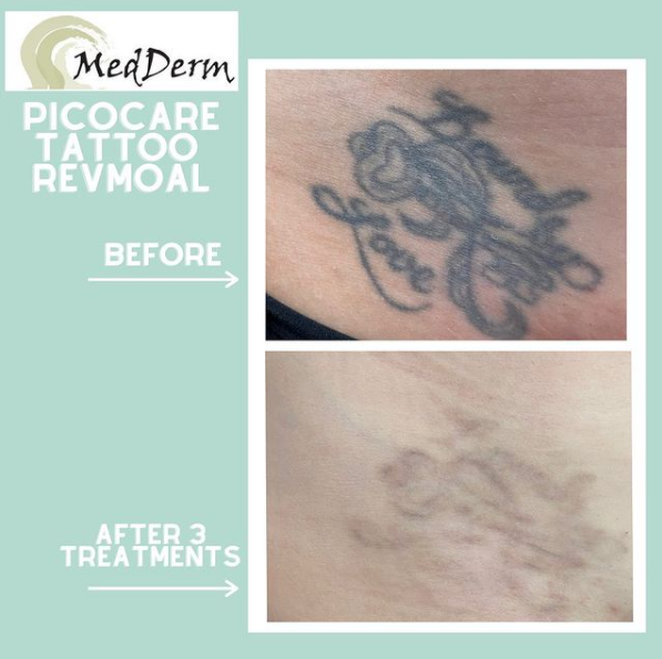 Images MedDerm Dermatology