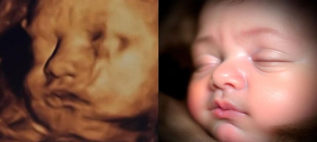 Images Chubby Cheeks 3D/4D Ultrasound Studio of Amarillo