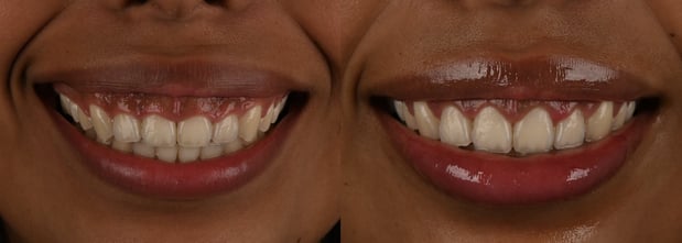 Images Hoopes Dental