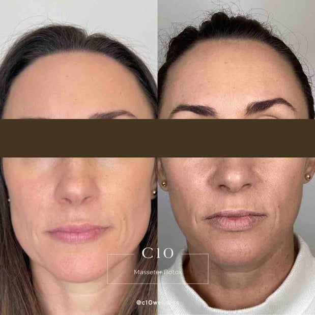 Images C10 Wellness and Rejuvenation