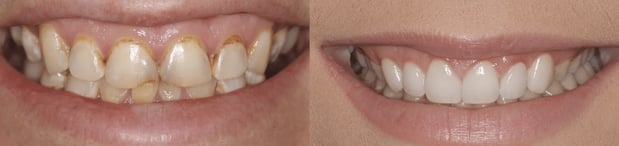 Images Iroquois Dentistry